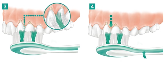3 & 4. Motion Phase: The brush head