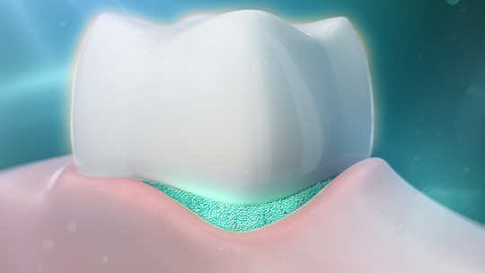 What causes sensitive teeth